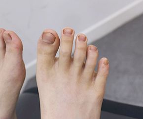 13세 남성 · 5개월 경과