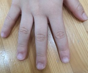 6세 여성 · 9개월 경과